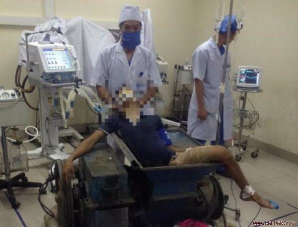 Nạn nhân bị máy làm gạch nghiền nát một bên chân