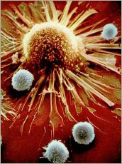 Virus HIV tan cong te bao