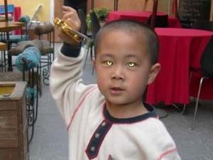 Cậu b� Nong Youhui với đ�i mắt s�ng kỳ lạ. Ảnh: kazan.kp.ru.