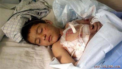 Một em nhỏ bị thương trong vụ nổ đang được điều trị tại bệnh viện tỉnh Farah ngày 20/11 (Ảnh: Reuters)