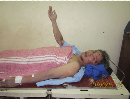 Tai nạn kinh hoàng: Sập khách sạn, 13 người bị vùi lấp