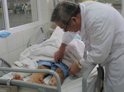 Bệnh nhân não mô cầu đầu tiên tại miền Bắc