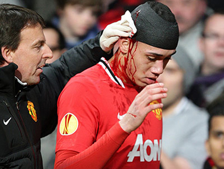 HUm nay, đánh nhau ... - 3