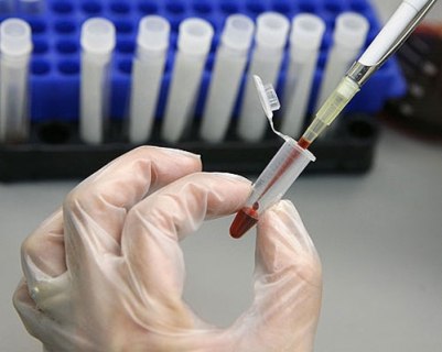 Chẩn đoán cơn đau tim bằng cách thử máu