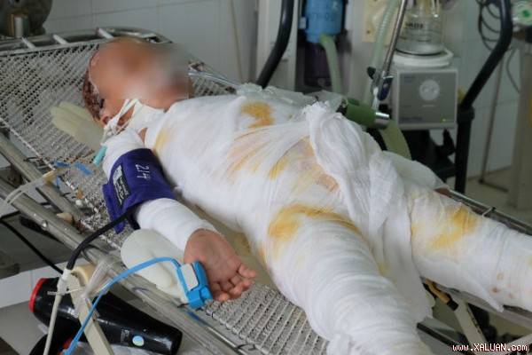 Tạm thời cháu H đã qua cơn nguy kịch nhưng vẫn đang hôn mê.