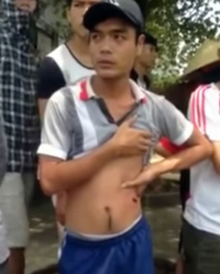 Nguyễn Thanh Nghĩa bị thương nhẹ ở hông do đạn cao su - Ảnh cắt từ video