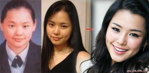 6 ‘Bông hậu’ xứ Hàn lột xác nhờ cắt mí