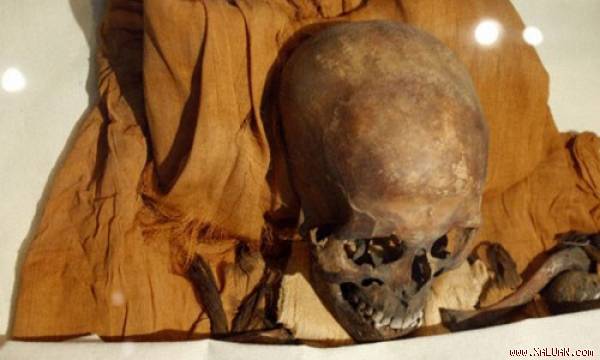  Thi hài của pharaoh Akhenaten được khai quật với khuôn mặt bị dài ra và phía sau đầu có hình dáng quả trứng.