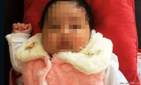 Bé gái Asha bị bỏng nặng ở Nauru được đưa tới Australia chữa trị. Ảnh: CNN