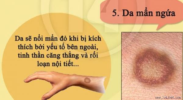 Dấu hiệu cho thấy cơ thể bạn đang ‘kêu cứu’