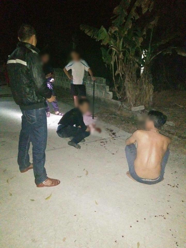 Tên trộm sợ hãi sau khi bị đánh - (Facebook Thay Phan)