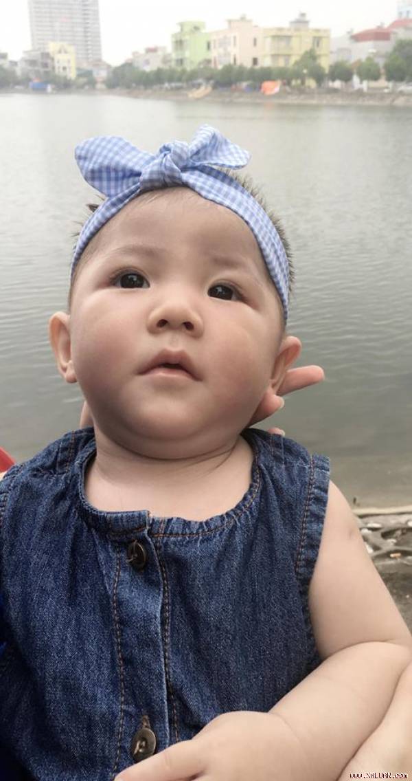    Sau 1 tháng được điều trị, chăm sóc bé Yên Nhi đã tăng được 4kg. Hiện bé có cân nặng 7,5kg. Ảnh: FBNV