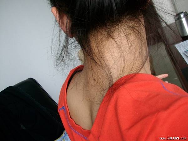 Má lúm đồng tiền, nốt ruồi trước ngực, nốt ruồi sau gáy