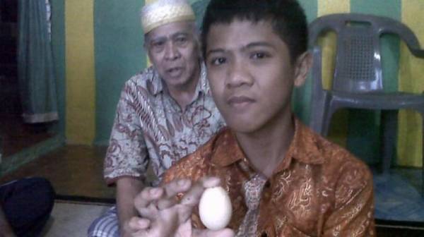 Cậu bé Akmal đẻ ra 7 quả trứng trong một tuần.