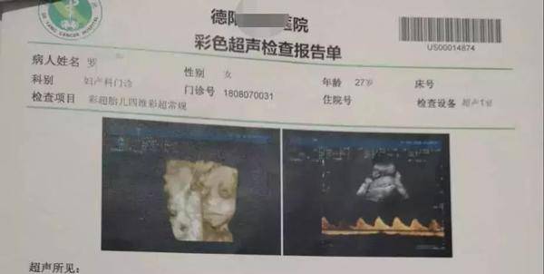 Khi siêu âm thai cho chị Luo, bác sĩ nói bé thích nắm chặt tay lại.