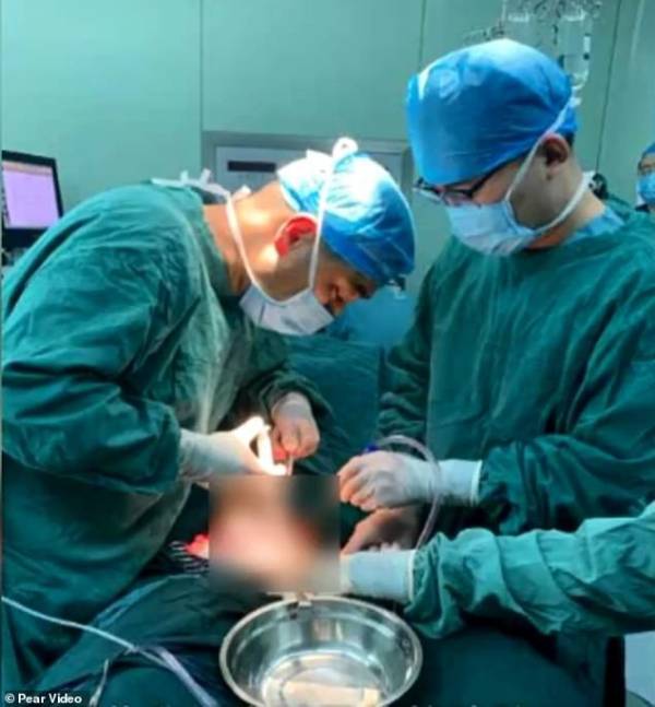 Các bác sĩ tại Bệnh viện Nhi Tây An tiến hành phẫu thuật cho cậu bé.