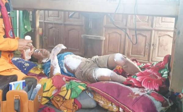 Ông Đào Văn Nguyên bị bỏng nặng khi đánh bắt cá trên Vịnh Bắc Bộ - Ảnh: Vietnam MRCC