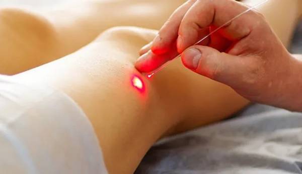  Công nghệ laser mới mang lại hi vọng chữa bệnh ung thư tốt hơn.