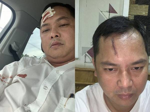 Vết thương trên trán ông Lê Võ Trường Hải - ảnh: CTV