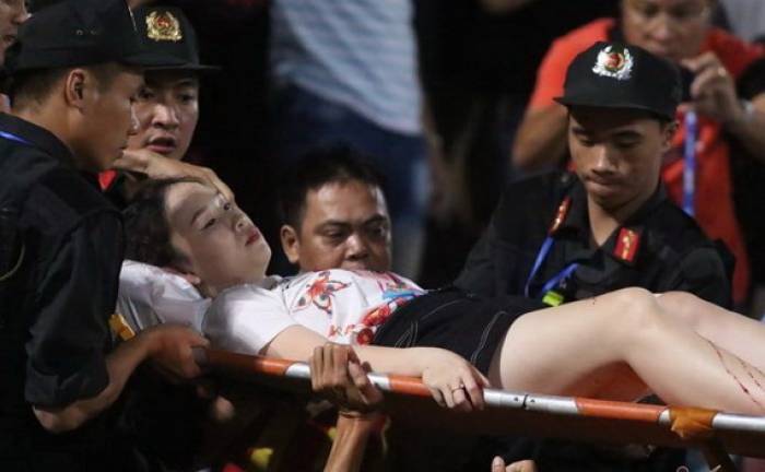 Nữ CĐV không may bị trúng pháo sáng. Ảnh: Vietnamnet